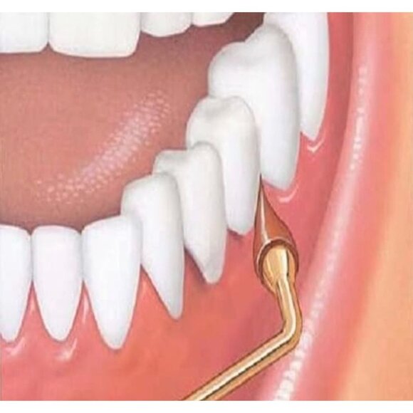 Sunstar GUM Stimulator Oral Gum Health Oral Hygiene Dental - Picture 4 of 7